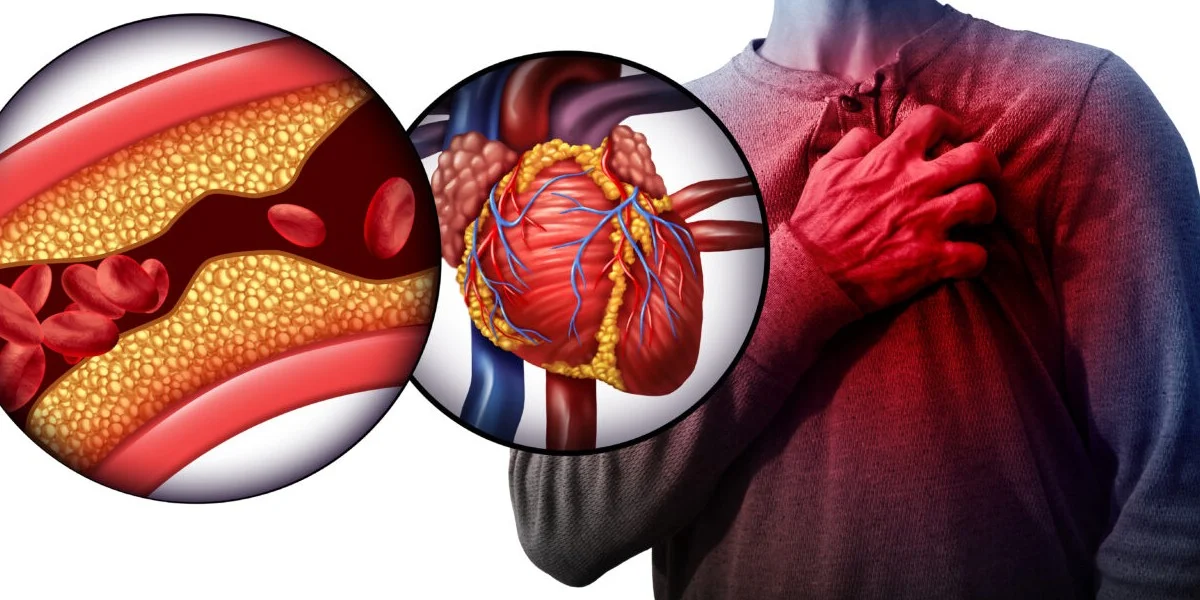 کلسترول چیست