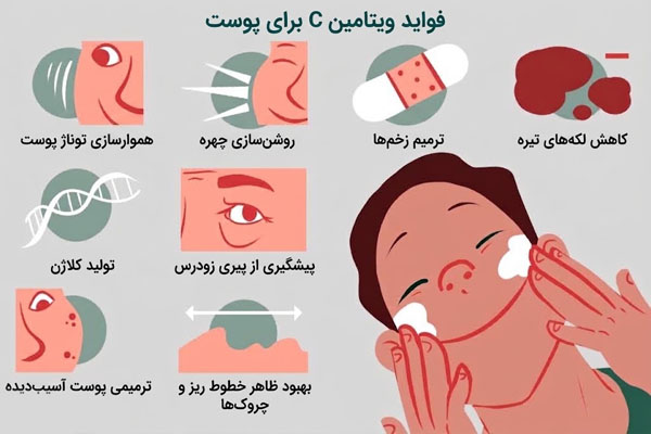 اینفوگرافیک فواید ویتامین C برای پوست